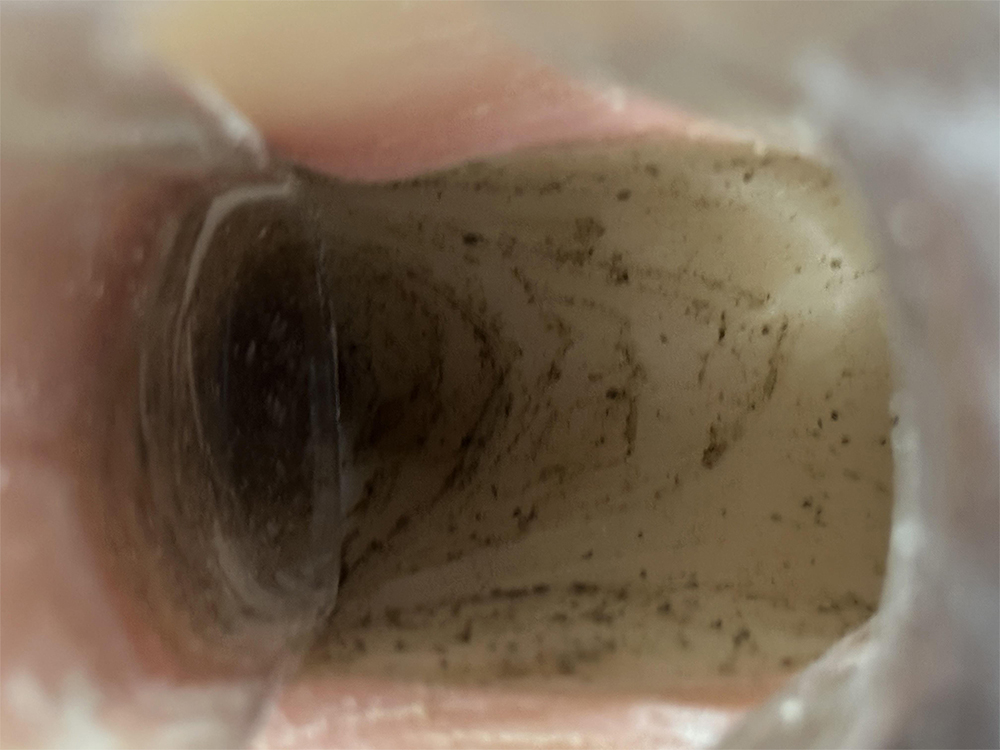mold spots